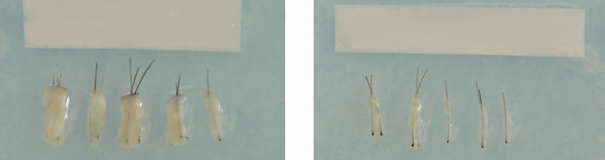 모발이식 생착률을 결정하는 모낭의 차이 2 image 29