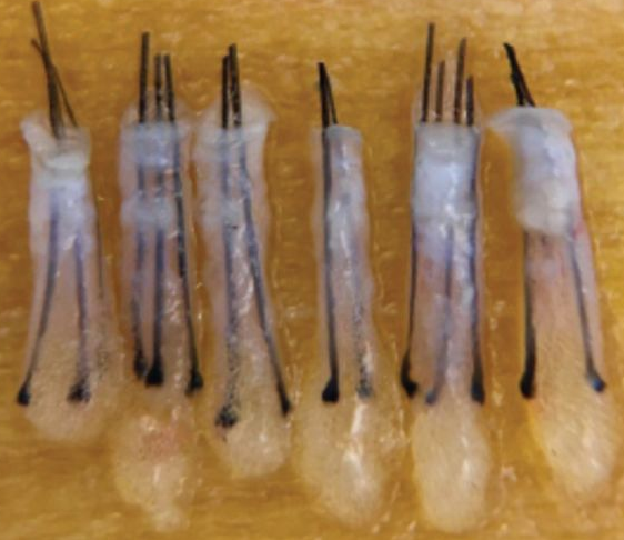 모발이식 생착률을 결정하는 모낭의 차이 3 image 30