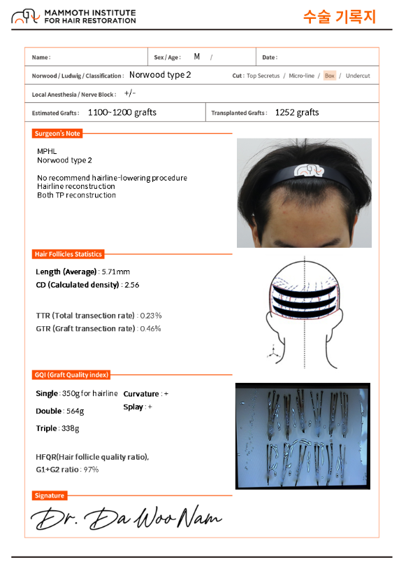인천 비절개모발이식 M자 탈모 11개월 기록 후기 2 image 11