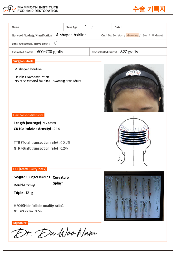 인천 비절개모발이식, 여자 잔머리유지 M자 헤어라인 최종 후기 2 image 7