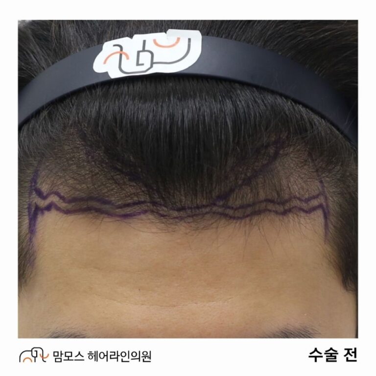 블로그 18