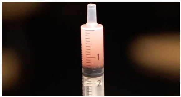 리제네라 액티바(Regenera Activa), 정말 효과 있을까? 2026 최신 메타분석으로 살펴본 탈모 치료의 가능성 2 image 17