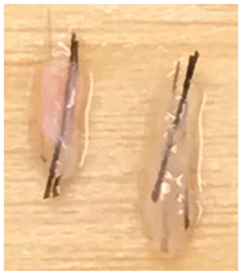 인천 모발이식 | 모낭이 손상되면 생착률은 얼마나 떨어질까? 모낭 손상 4가지 3 image 2